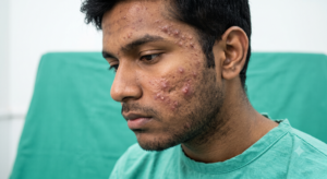 Dr Prachi Chhindam aesthetic surgeon