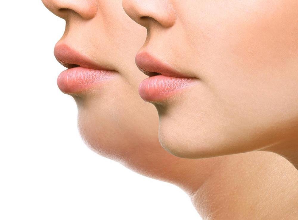 Dr Prachi Chhindam aesthetic surgeon