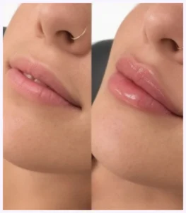 Dr Prachi Chhindam aesthetic surgeon