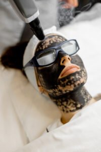 Carbon Laser Peel in Pune