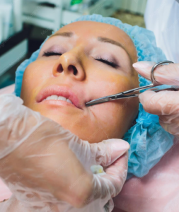 Surgical Lip Enhancement in Pune