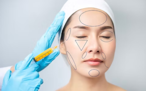 Facial Fat Grafting in Pune