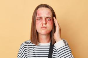 Facial Trauma Surgery in Pune