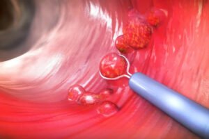 Facial & Oral Biopsy in Pune