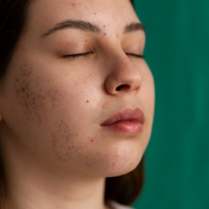 Dr Prachi Chhindam aesthetic surgeon