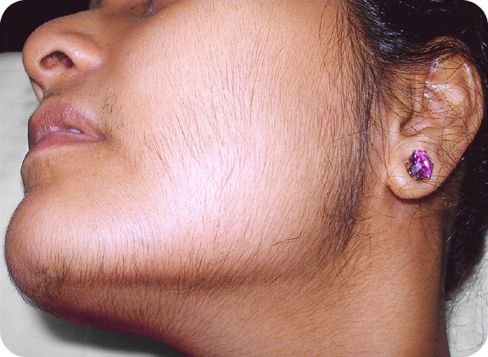 Dr Prachi Chhindam aesthetic surgeon